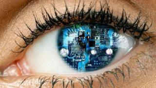 Glaucoma