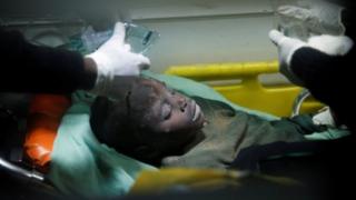 A child rescued from the rubble is treated by medics in Nairobi. Photo: 13 June 2017