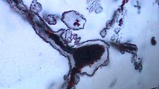 One of the earliest living organisms