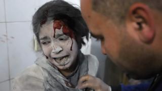 A Syrian girl receives treatment in the rebel-held enclave of Eastern Ghouta on March 7, 2018.