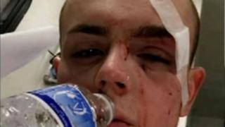 Gay punch victim