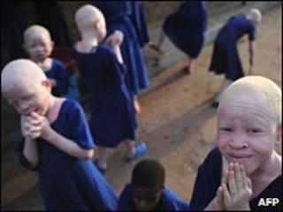 Albino children in Tanzania (file photo)