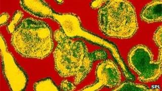 Image of respiratory syncytial virus
