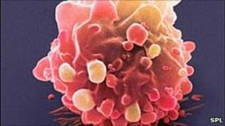Bowel cancer cell