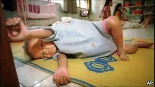 Abandoned HIV-infected baby, Phnom Penh Nutrition Centre, 1999