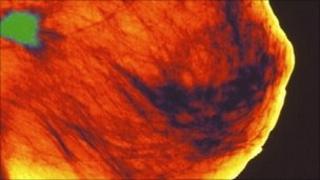 breast cancer scan