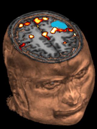 Brain scan