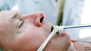 Ventilated man in intensive care