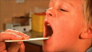 Doctor checking a child's tonsils