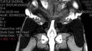 Turtle brain scan