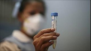 test tube