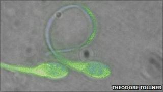 Sperm