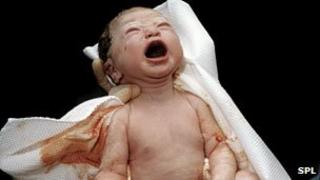 A newborn baby