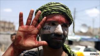 A Yemeni anti-government protester shows his blood-covered hand after helping wounded people during clashes between anti-government protesters and security forces in Sanaa