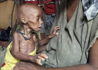 A severely malnourished child from southern Somalia is held in a makeshift shelter at a refugee camp in Mogadishu, Somalia, 20 September