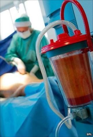 A surgeon performs liposuction