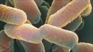 E.coli 0157