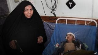 Five-year-old boy injured in Baghdad's attack and his mother
