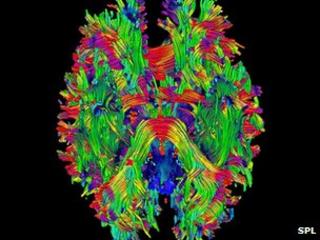 Brain tumour