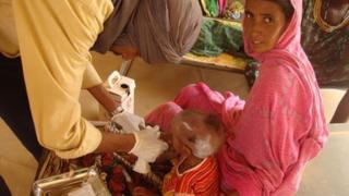 Mother and malnourished child in Mbera refugee camp