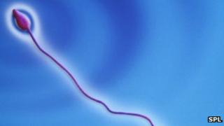 Sperm