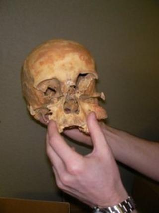 Human remains from Eynsham Abbey