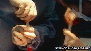 Bone marrow transplant