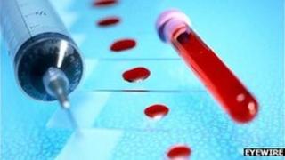 File pic of blood in test tube, syringe and slides