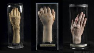 Wax hands made by Joseph Towne on display at the Museum of London