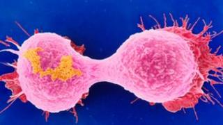 breast cancer cells