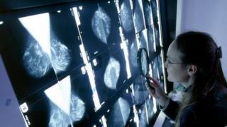 Mammograms