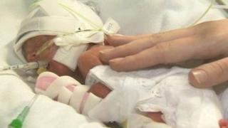 baby in intensive care