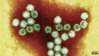 Norovirus