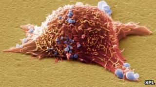 Skin cancer cell