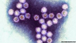 norovirus
