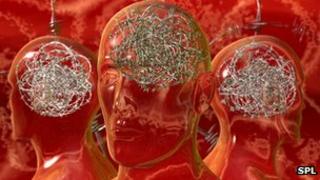 Artwork of how a migraine could feel