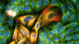 Cancer cells