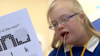 linking downs syndrome and leukemia essay linking downs syndrome and leukemia essay
