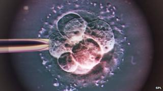 IVF