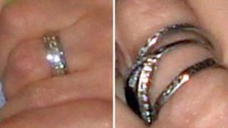 The rings stolen from the patient