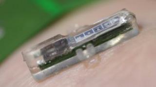micro implant developed by EPFL