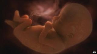 Foetus