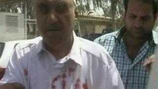 Injured man being brought for treatment, 6 April