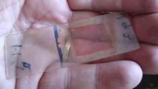 Sample of blood
