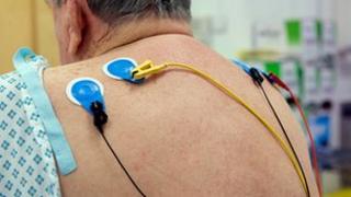 Heart monitoring