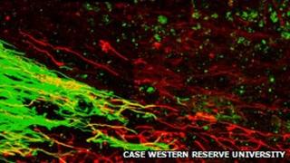 Nerve regeneration in the rat