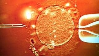 IVF