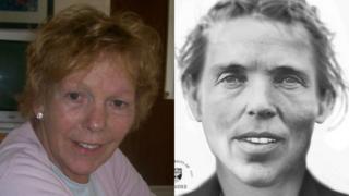 Phyllis Dunleavy and the facial reconstruction