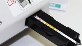 Urine dipstick test