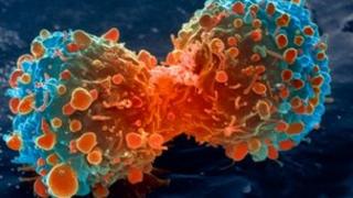 Lung cancer cell dividing